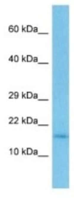 TEN1 Rabbit anti-Mouse, Polyclonal, Novus Biologicals 100 &mu;g; Unconjugated:Antibodies,